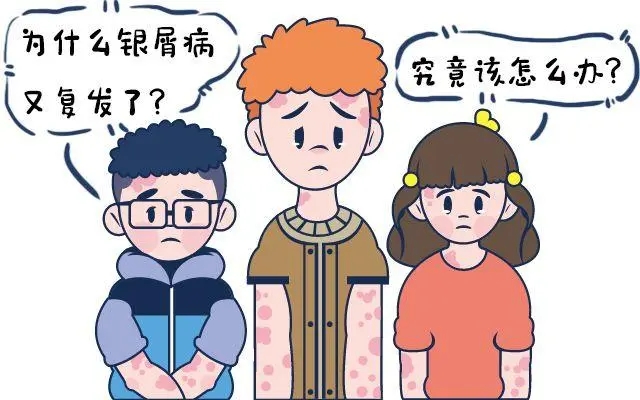 感冒会导致牛皮癣复发吗
