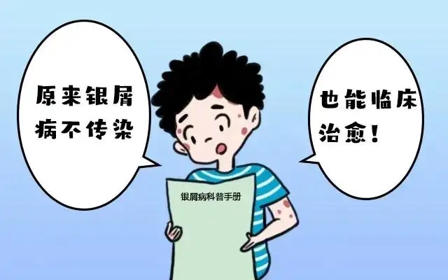 专家详解银屑病会传染吗