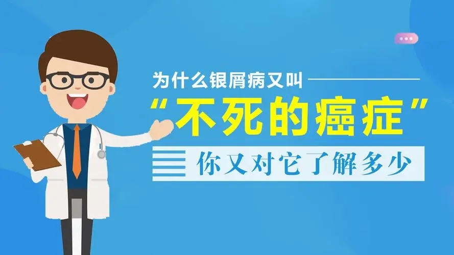 牛皮癣患者应该做什么样的检查
