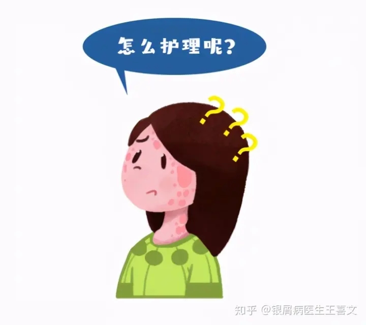 孕妇患有牛皮癣需要注意什么