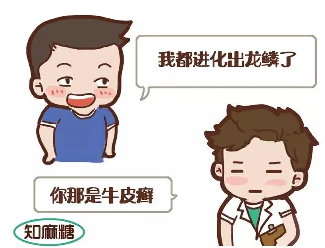 牛皮癣的检查方法是什么