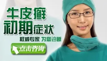 牛皮癣的常见症状有哪些