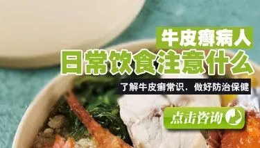 牛皮癣患者头皮屑增多该怎么饮食