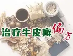 牛皮癣患者应谨慎选择偏方治疗